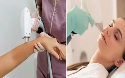 لیزر موهای زائد، مضر یا بی ضرر؟ مسئله این است!