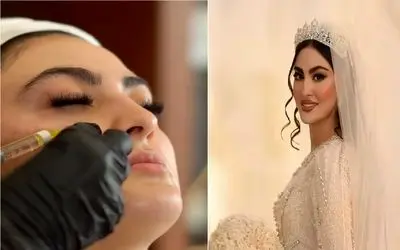 دنیای بازیگران؛ تزریقات زیبایی مریم مومن قبل از عروس شدن