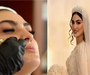 دنیای بازیگران؛ تزریقات زیبایی مریم مومن قبل از عروس شدن
