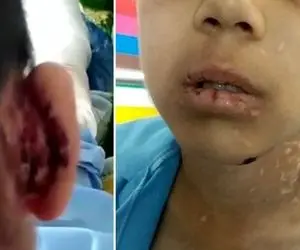 شکنجه فجیع دانیال کودک سبزواری توسط پدر و نامادری!