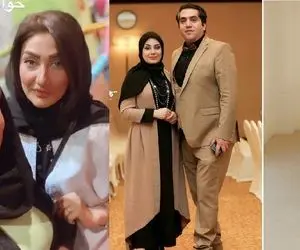 ظاهر عجیب صبا راد و همسرش وقتی فقط یه قدم مونده شبیه باربی و کن بشن؛ ابرو کاشت موکتی!
