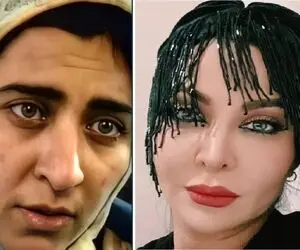 قبل و بعد فقیه سلطانی / تو معجزه خنده بیست سالش بود اونقد پیر حالا پنجاهه انقد جَوون