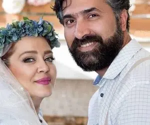 عمل زیبایی بهاره رهنما ؛ بوتاکس کردم! + ویدیو