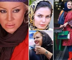 بازیگران زنی که تَه عمل ممل نون کشیدن؛ دماغو کوبیدن بینی تحویل گرفتن حتی شده سه باررر!