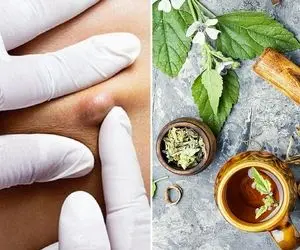 از بین بردن جوش های ران پا با ترفند راحت؛ با یکم از این روغن پاهاتو صاف صاف کن