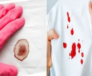 پاک کردن لکه خون خشک شده از رو لباس و ملحفه؛ جوری تمیز شه که خودتم شک کنی لکه ای بوده
