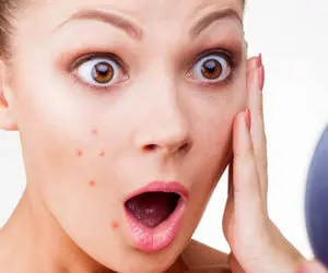 5 قدم تا پایان جوش؛ از تاثیر بی نظیر این دمنوش های گیاهی روی جوش صورت غافل نشووو!