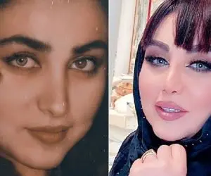 بهنوش بختیاری خوب شد دماغش را عمل کرد! +عکس قبل از عمل