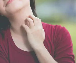 ۹ درمان خانگی برای رهایی از اگزما
