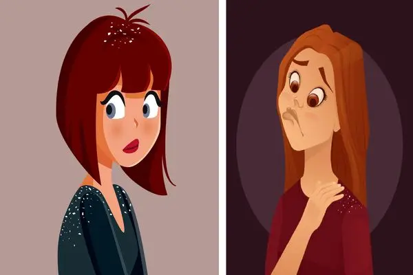 Natural Hair Dandruff: 7 Natural Remedies For You