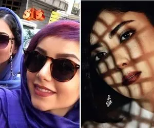 "زیبا کرمعلی" مرزای زیبایی رو جابجا کرده ضربتی؛ نشونه های اروپایی تو فِیسش چی میگه!