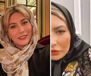 "فریبا نادری" اول با فیلتر صورتشو صیقلی کرده بعد دست و پا درآورده؛ با بلک تیپ چه شود!