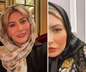 "فریبا نادری" اول با فیلتر صورتشو صیقلی کرده بعد دست و پا درآورده؛ با بلک تیپ چه شود!