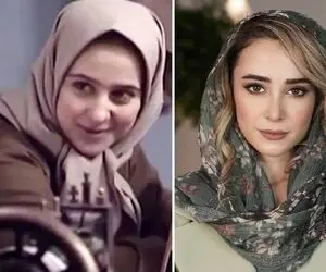 فرق الناز حبیبی چهل ساله با نوزده ساله / عمل بینی بعد از سریال روزگار قریب جادو کرد