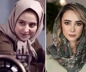 فرق الناز حبیبی چهل ساله با نوزده ساله / عمل بینی بعد از سریال روزگار قریب جادو کرد