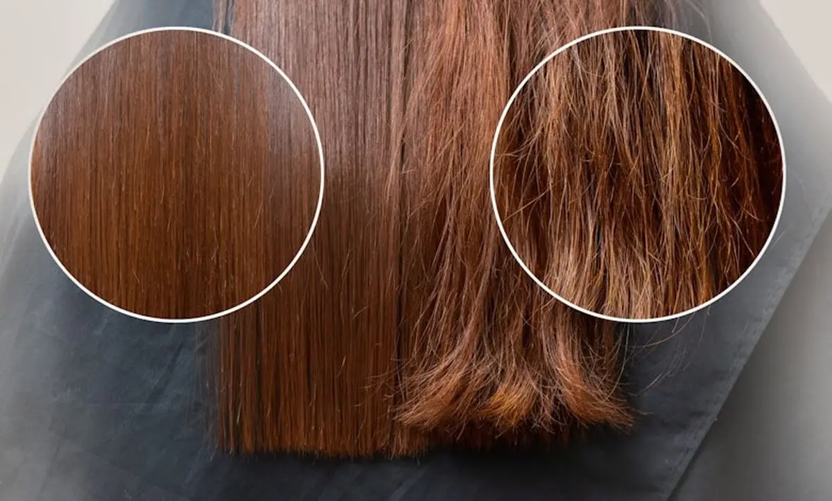 what-to-do-to-eliminate-and-treat-hair-leprosy-07