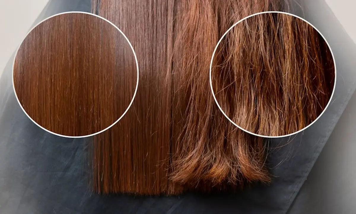 what-to-do-to-eliminate-and-treat-hair-leprosy-07