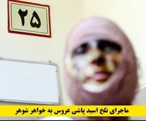 حمله اسیدی؛ هدیه عروس برای نامزدی خواهر شوهر