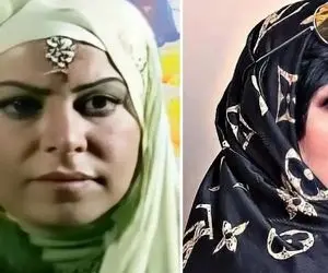 قبل و بعد فلور نظری / از نسرین خانه به دوش رسید به فعالیت مدلینگی تو جراحی زیبایی