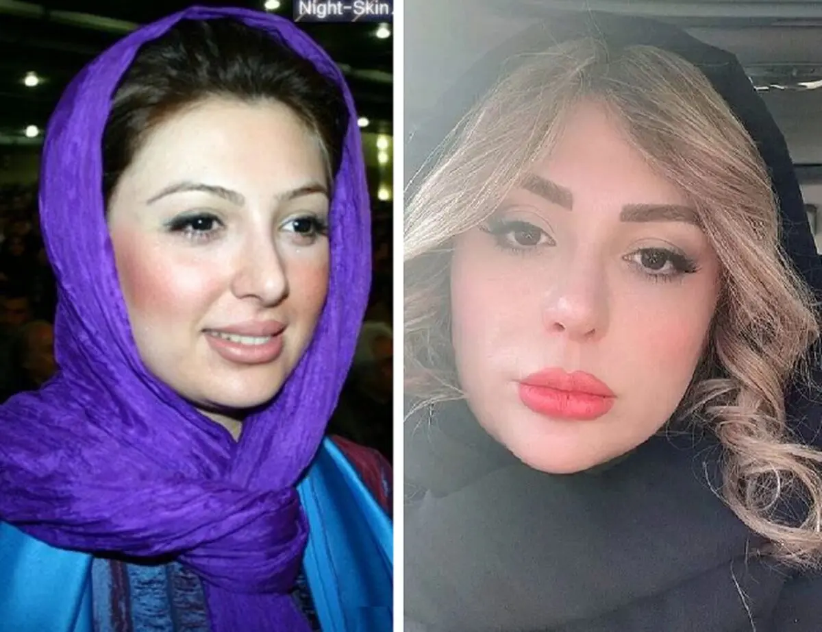 نیوشا ضیغمی