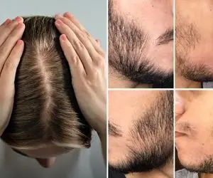 پزشک پوست و مو در کرج؛ حاذق ترین متخصصان البرز برای پوست، مو و لیزر + نظرات مردم