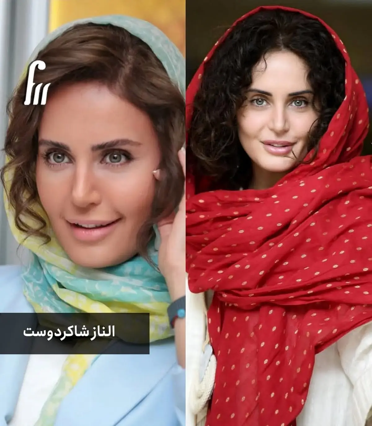 دنیای بازیگران؛ قبل و بعد سلبریتی ها با موی تیره و روشن / چی به کی میاد؟ دنیای بازیگران؛ قبل و بعد سلبریتی ها با موی تیره و روشن / چی به کی میاد؟