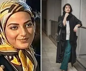 پس و پیشِ طناز طباطبایی از میوه ممنوعه تا یاغی / با عمل بینی یه طناز امروزی شکفت