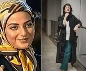 پس و پیشِ طناز طباطبایی از میوه ممنوعه تا یاغی / با عمل بینی یه طناز امروزی شکفت