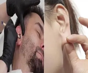 از بین بردن موهای رو و داخل گوش؛ هیچ خودتو تو دردسر و زحمت ننداز یه ذره شکر میخوای