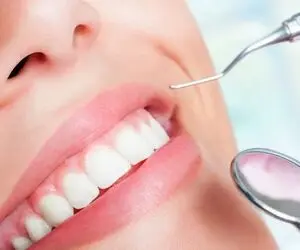 افزایش تقاضای برای خدمات دندانپزشکی زیبایی در پایتخت