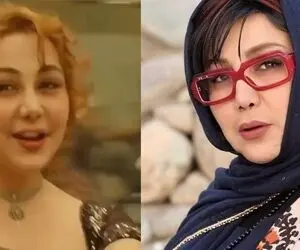 (عکس) بهنوش بختیاری با لب هایی شتری و نامتعارف !