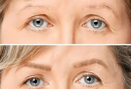 دلیل ریزش ابرو چیست؟ / چند روش خانگی سریع برای پرپشت شدن ابروها و زیبایی دوچندان
