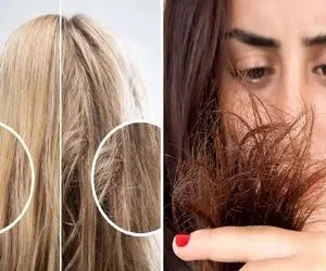 از بین بردن موخوره با سه روغن گیاهی؛ رفع چند شاخه شدن زیاده مو در 1 هفته بدون کوتاهی