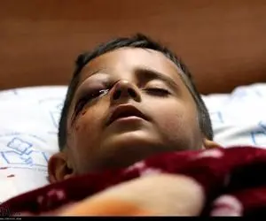 مصدومیت های شدید افراد در چهارشنبه سوری سال 99 