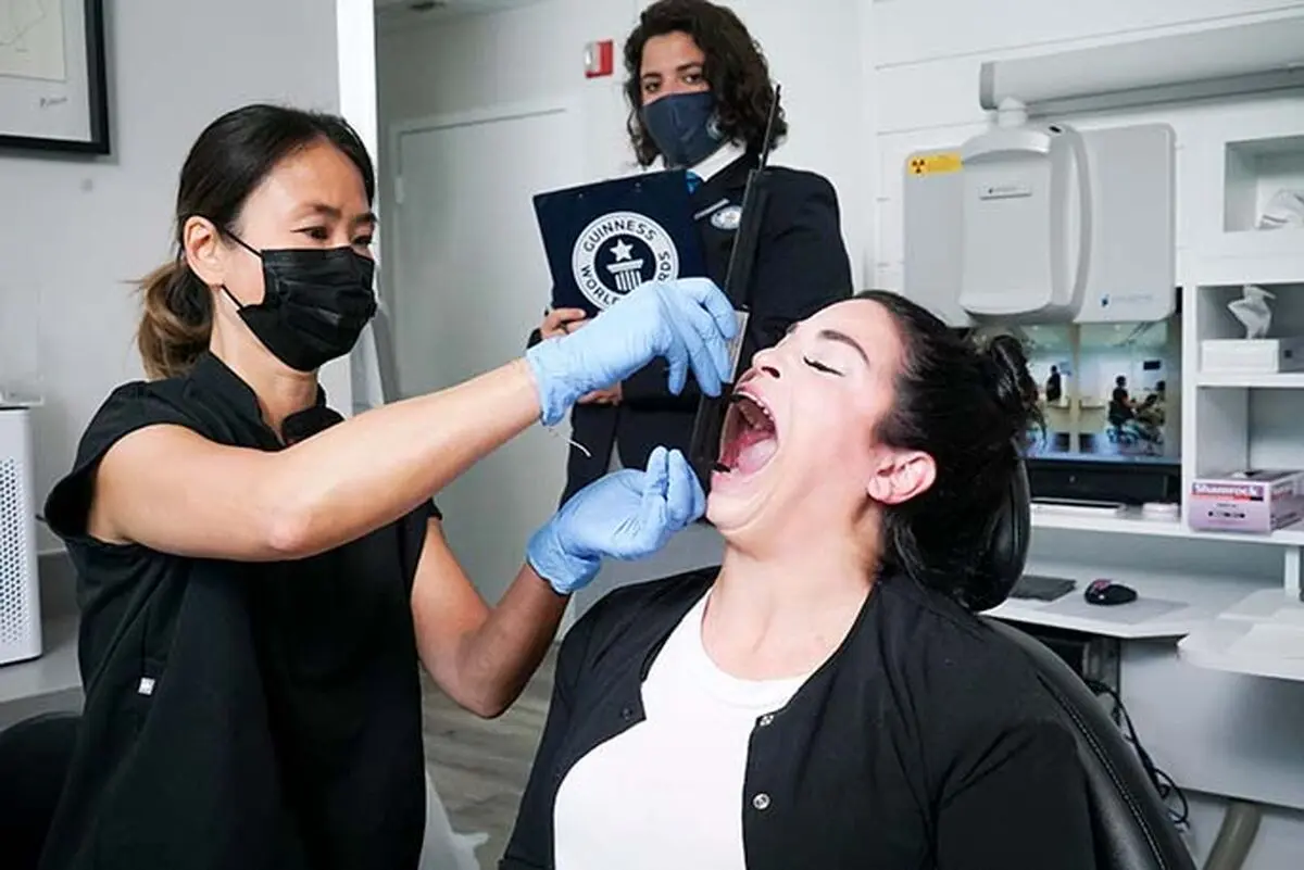 Largest-mouth-gape-record-holder-sam-ramsdell-has-mouth-gape-measured-by-dentist_tcm25-669449