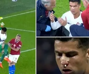 (عکس) شب عجیب رونالدو؛ از صورت خونین تا هند پنالتی!