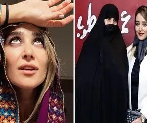 "الناز حبیبی" با یه عالمه گچ زیر چشمش همچنان از رفیقش تو فیس عقبه؛ اینا کفشه یا نردبون