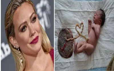 خوردن جفت پس از زایمان؛ از غریزه حیوانی تا مد سلبریتی‌ های غربی