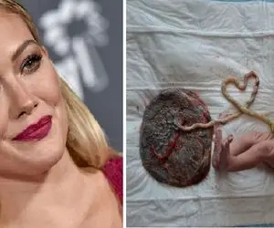 خوردن جفت پس از زایمان؛ از غریزه حیوانی تا مد سلبریتی‌ های غربی