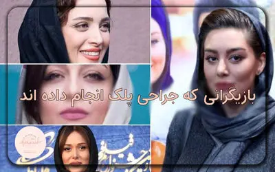 بازیگرانی که بلفاروپلاستی انجام داده اند