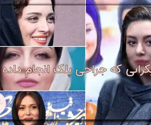 بازیگرانی که بلفاروپلاستی انجام داده اند