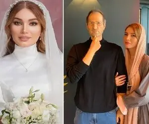 چجوریه که چهره متین ستوده یهو دهن باز میکنه لوازم آرایشو میخوره! واقعا این قبل عملشه؟