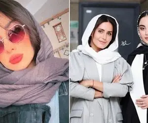 وقتی پروتزای "ترلان پروانه" هی قد میکشن و شدن قد هندوانه؛ خانوم عین جعبه جواهر متحرکه!