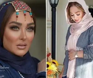 الهام حمیدی جلو همه کَلشو کرد تو دبه برنز؛ میگن بُکش و خوشگلم کن نمونه بارزش!