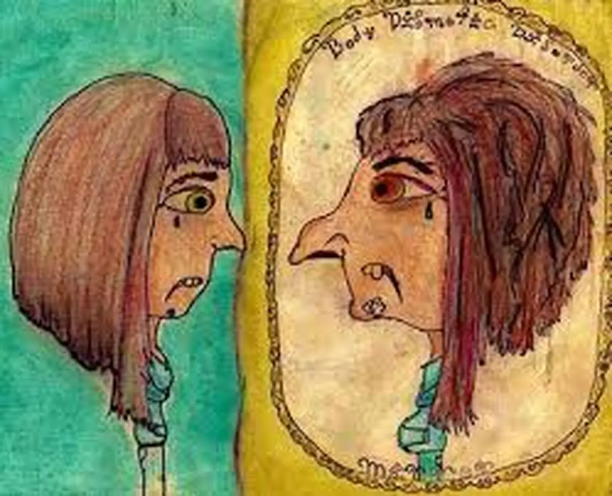 خود زشت پنداری