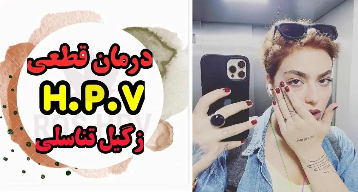 reyhaneparssaa_2683001551240492849_8459886880