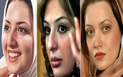 کدوم بازیگر خوشگلترین عمل بینی رو داشته؟/ همراه با معرفی دکتراشون که کارشون حرف نداره