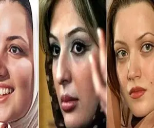 کدوم بازیگر خوشگلترین عمل بینی رو داشته؟/ همراه با معرفی دکتراشون که کارشون حرف نداره