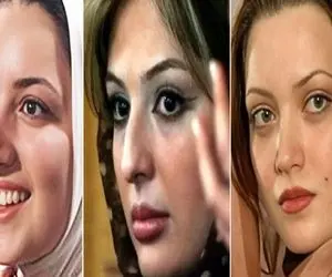 کدوم بازیگر خوشگلترین عمل بینی رو داشته؟/ همراه با معرفی دکتراشون که کارشون حرف نداره