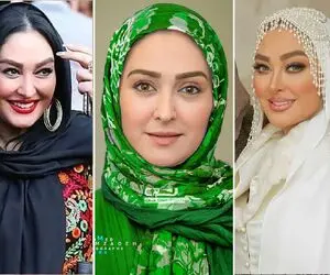تغییر چهره زیرپوستی "الهام خانمِ" از خودراضی؛ ولی عجب پلنگیم کرد خودشو!